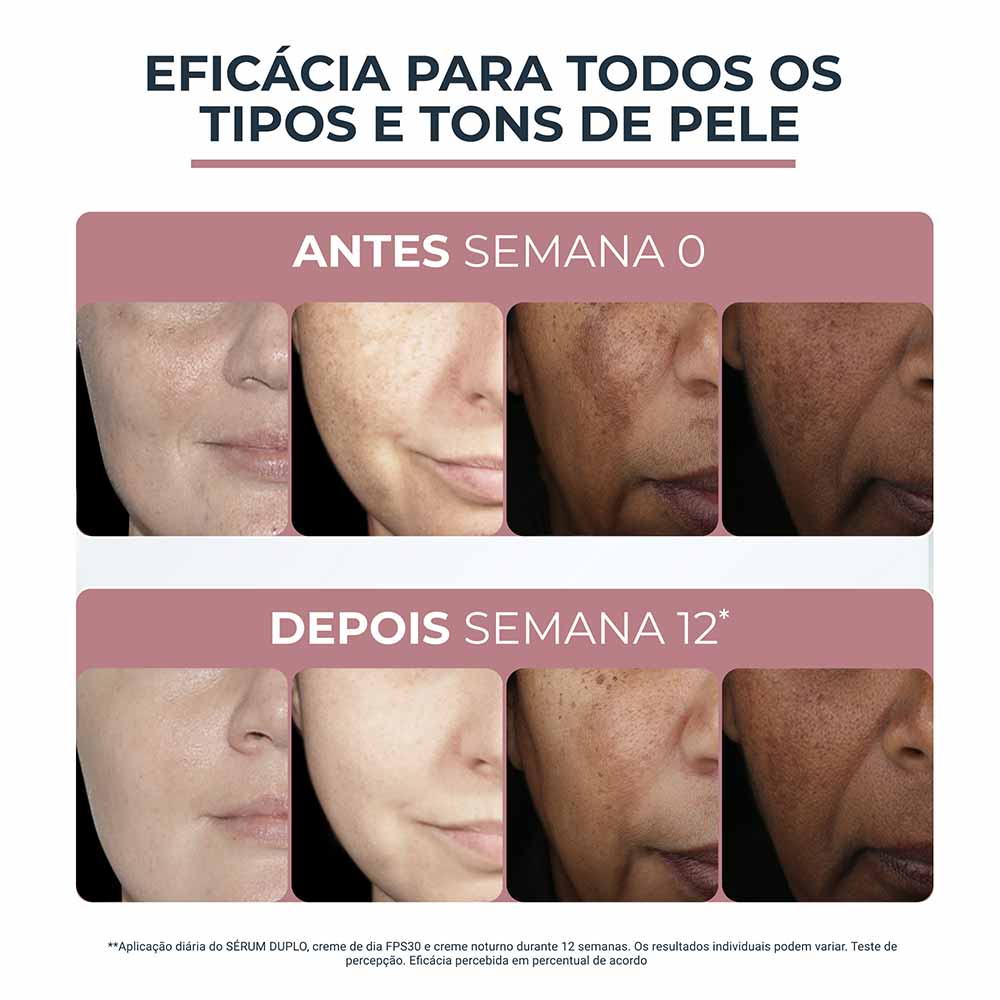 Sérum Facial Eucerin Anti-Pigment Clareador Dual Sérum 30ml