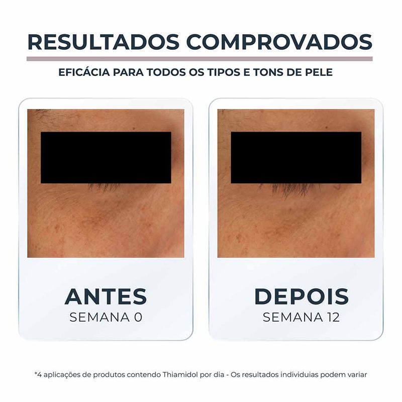 EUCERIN Creme de Olhos Clareador de Olheiras Anti-Pigment 15ml