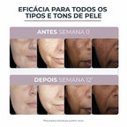 Creme Facial Eucerin Anti-Pigment Noite 50ml